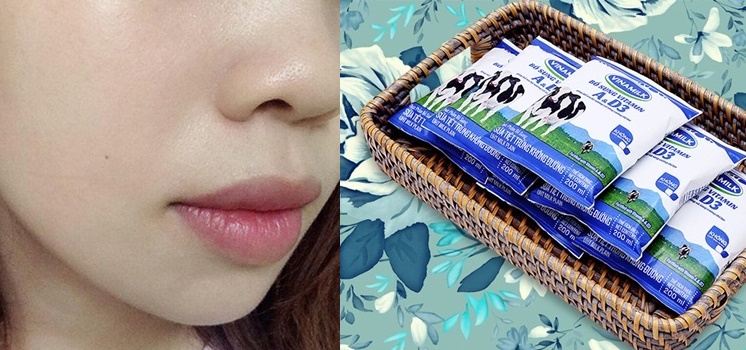 Cách khắc phục lỗ chân lông to trên mặt hiệu quả mãi mãi