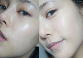 Để làn da luôn căng mọng và trẻ lâu với 8 bí quyết này!