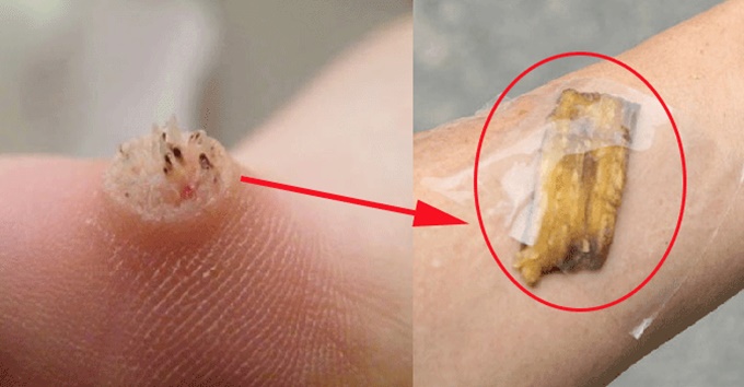 Mười mẹo cực hay của vỏ chuối không biết thì “tiếc đứt ruột”