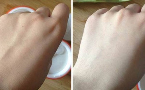 Tuyệt chiêu lột xác làn da đen nhẻm hóa trắng bóc như lột ngay lần đầu sử dụng chỉ với 1 nắm lạc dùng theo cách này