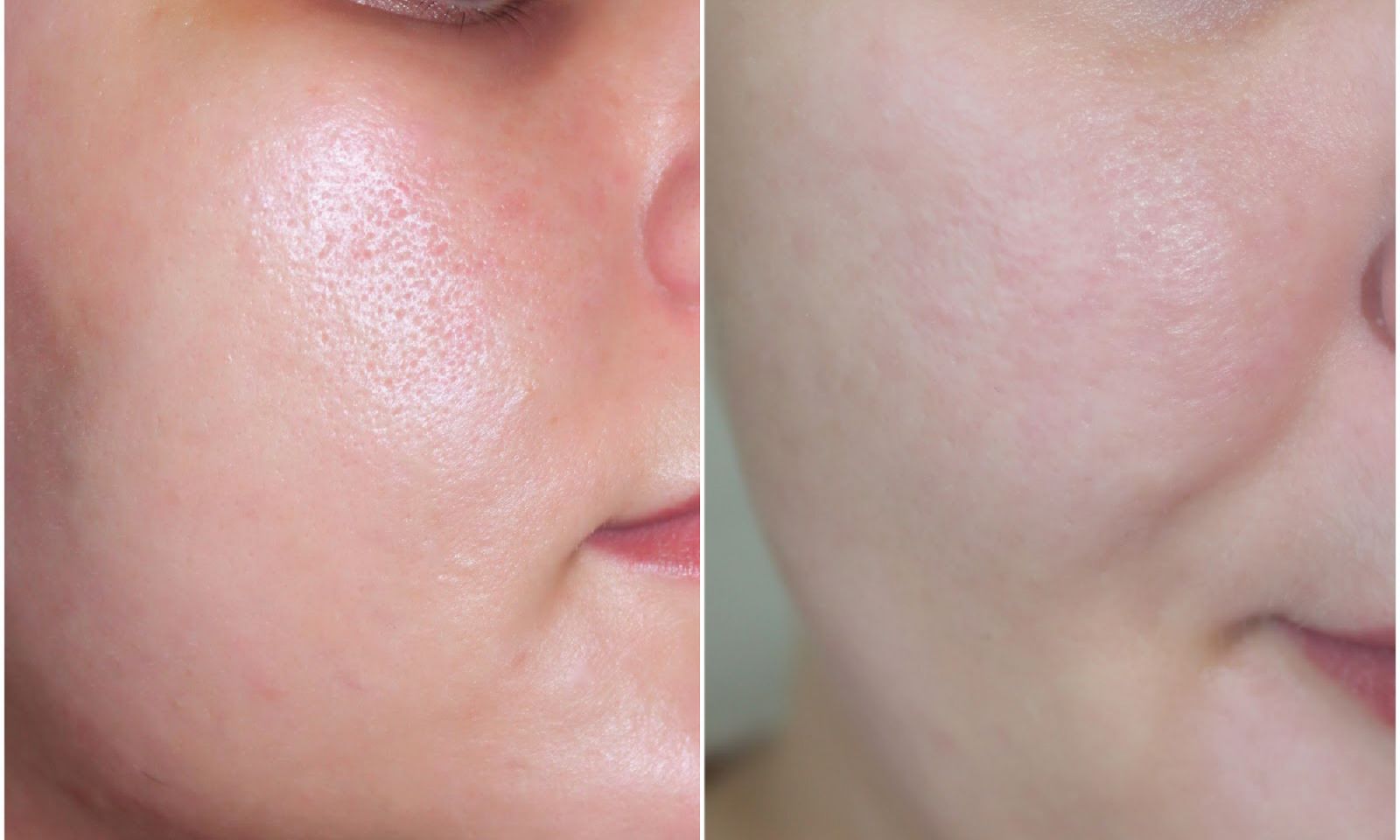 Năm sự thật ngã ngửa về lỗ chân lông khiến bạn choáng nặng