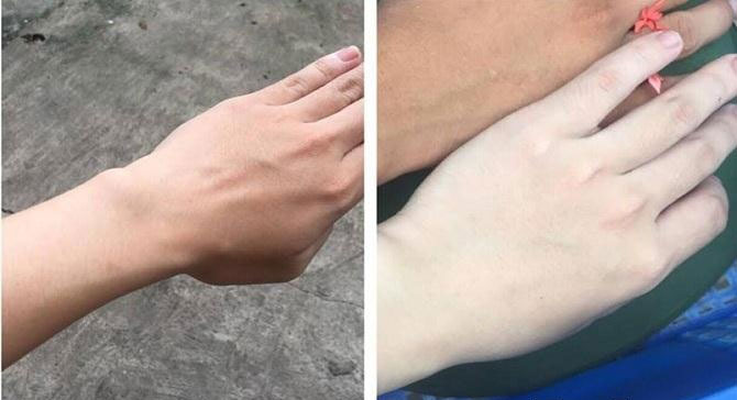 Chỉ mất 4-6 lần tắm bột cám gạo, da nàng nữ sinh trường Y đã trắng muốt bất ngờ