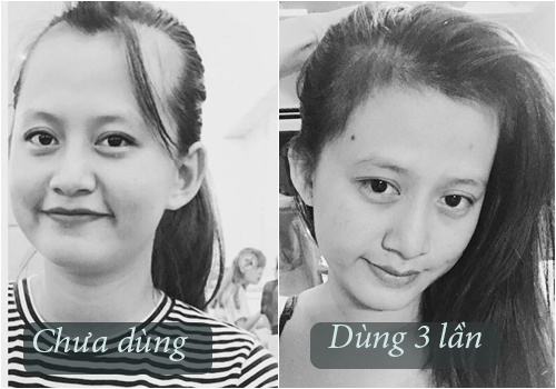 Băm sả thật nhỏ để ngâm với dầu oliu, hỗn hợp thượng đẳng giúp trị gàu kinh niên, giảm tóc gẫy rụng chỉ sau 1 lần gội