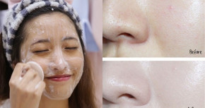 Bí quyết thu nhỏ lỗ chân lông sau 1 đêm chỉ bằng 1 gói sữa tươi rẻ tiền