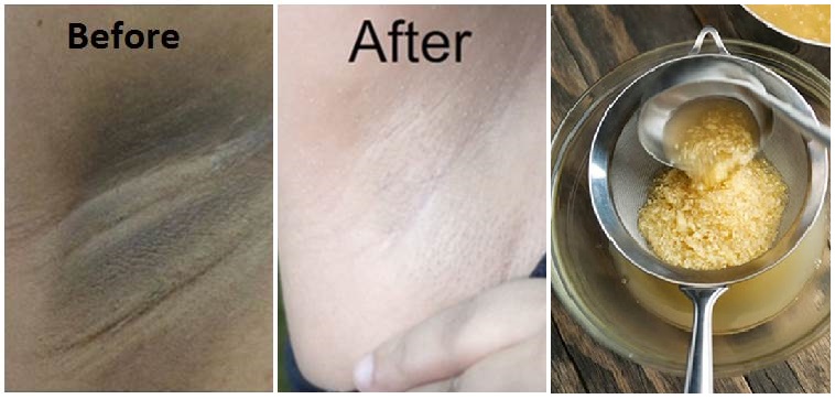 Nách thâm do cạo hay do nhổ cũng trở nên trắng sáng khi chà thứ này 2 phút mỗi ngày