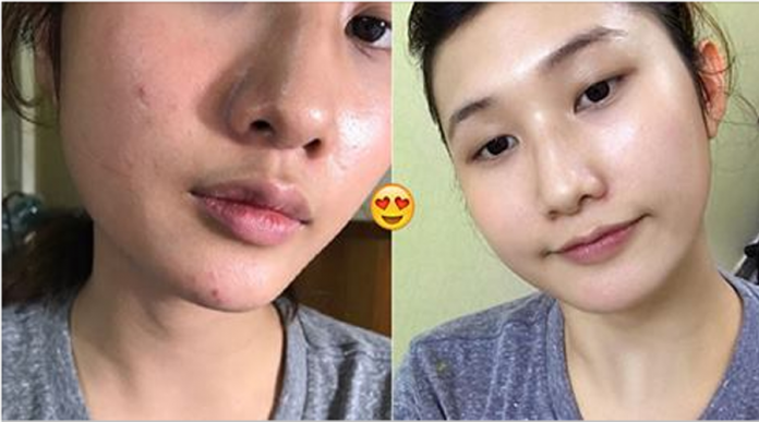 Học cách chăm da của người Nhật, cô nàng vui mừng vì mụn một đi không trở lại, lỗ chân lông được se khít