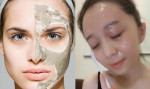 Có thật đắp mặt nạ 2 lần/ngày sẽ cho bạn làn da đẹp như em bé?