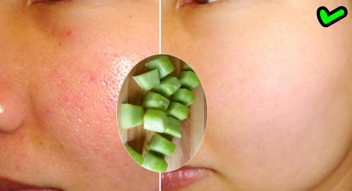 Chỉ cần 1 viên đá “THẦN THÁNH” này mỗi ngày giúp da bạn sáng mịn, se khít lỗ chân lông