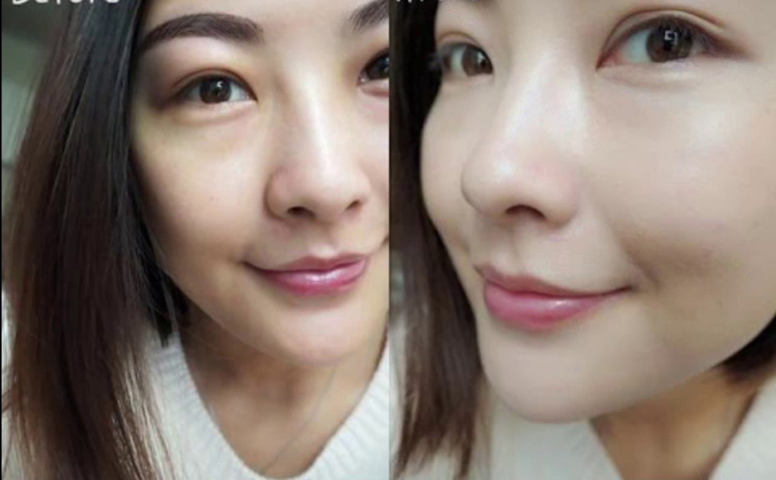 Nhẹ nhàng cuốn hút bao ánh mắt với làn da sạch thâm mụn, sạm nám, trắng sáng diệu kì