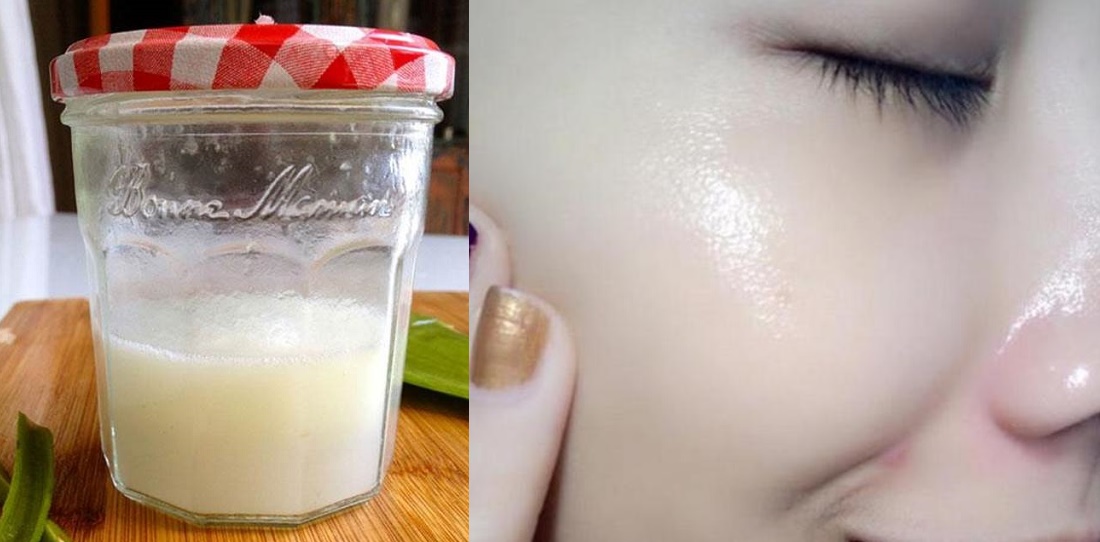 Sạch mụn, giảm thâm, da trắng hồng chỉ bằng dùng 1 vỉ Aspirin rẻ tiền