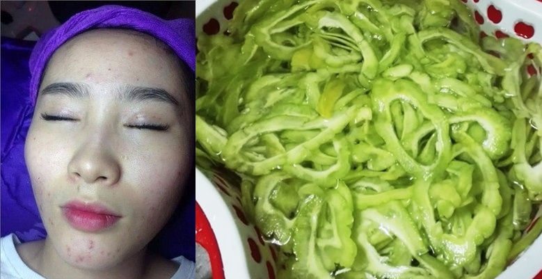 Loại bỏ hoàn toàn mụn thâm, nám da bằng mướp đắng non