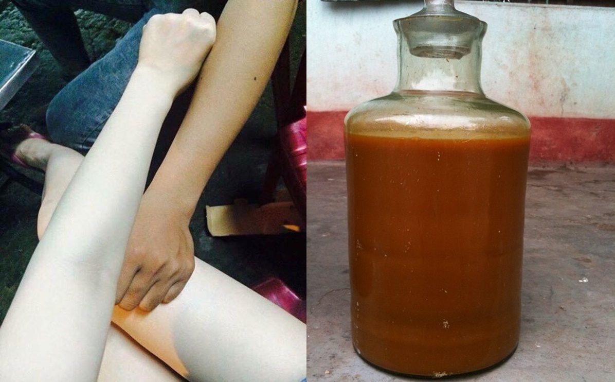 Công thức lột xác hoàn toàn da trắng dáng đẹp nhờ dùng rượu gừng nghệ