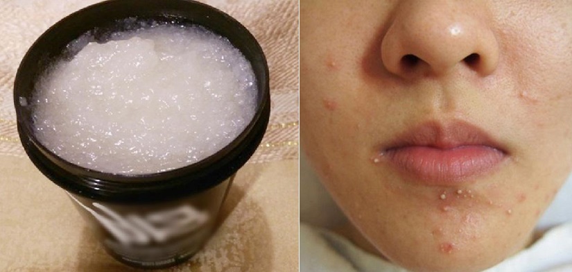 Top 10 mẹo làm đẹp trời ban của đường giúp hội con gái luôn xinh đẹp, tỏa sáng