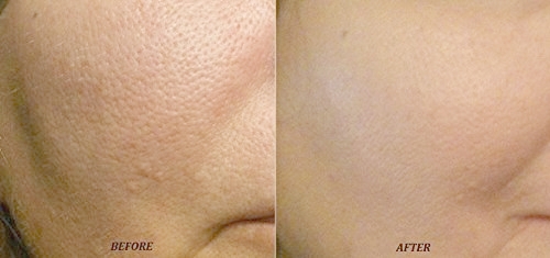 Se khít nhỏ lỗ chân lông bằng củ sả