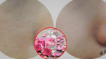 3 bước để lỗ chân lông mãi không to trở lại chỉ sau 1 tuần