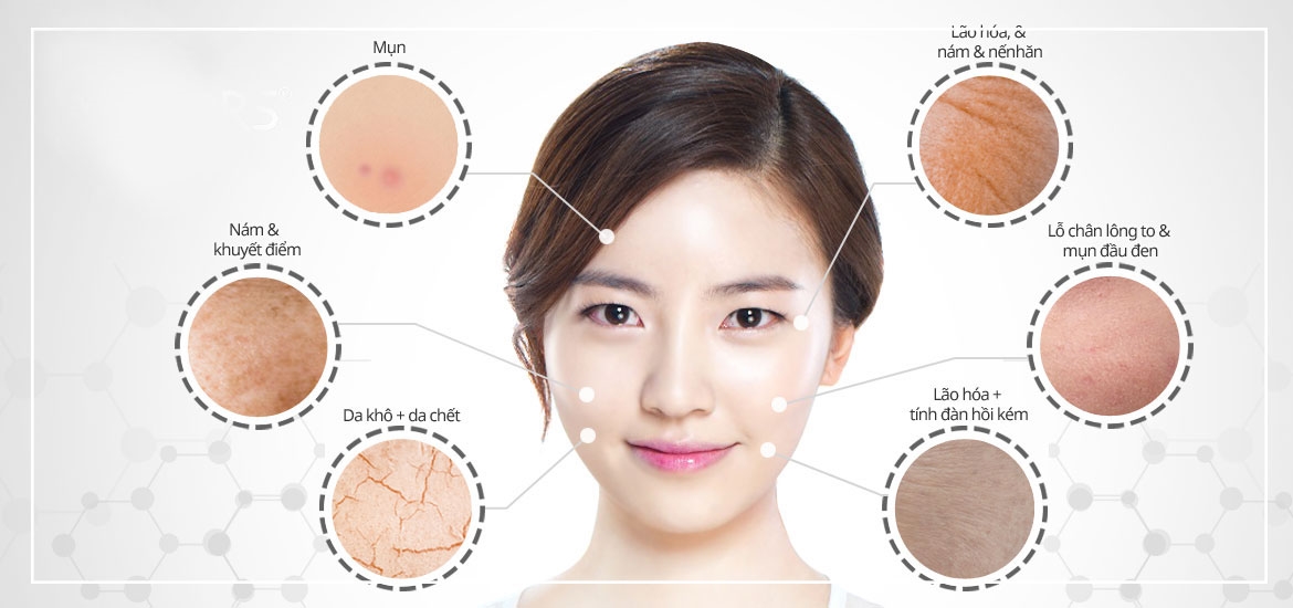 Chăm sóc da hoài mà không đẹp là do bạn chưa biết phân loại da chuẩn