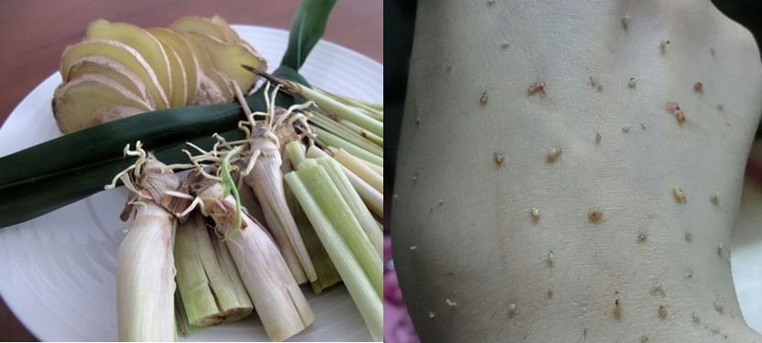 Đun gừng – xả – chanh để xông mặt, mụn trồi lên, da căng bóng và láng mịn chỉ sau 1 đêm