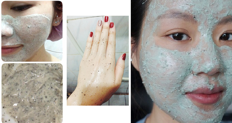 Mụn ẩn trên trán, dưới cằm và hai bên má sẽ “không cánh mà bay” sau 2 tháng nhờ cách này