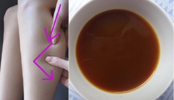 Mỗi ngày xoa thứ này 5 phút, chân voi, đùi to như cột đình biến thành thon dài