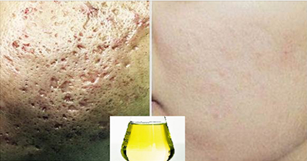 Da đẹp mướt rượt, khít khìn khịt với loại nước ‘thánh’ có sẵn trong nhà