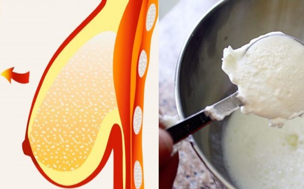 Mát xa “núi đồi” với hỗn hợp này – Vòng một chảy xệ cũng săn chắc như gái đôi mươi