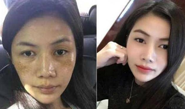 Dùng dưa chuột với 3 nguyên liệu này, da nám hay tàn nhang chi chít cũng sáng...