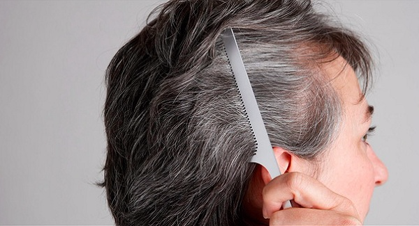 Vị trí tóc bạc tiết lộ tình trạng sức khoẻ của bạn – Cách trị liệu theo Đông y