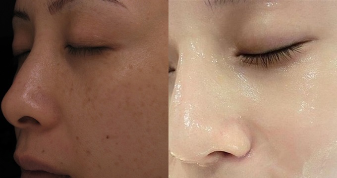 Da ngăm đen bẩm sinh cũng trắng bóc sau một đêm bôi nửa quả chuối chín