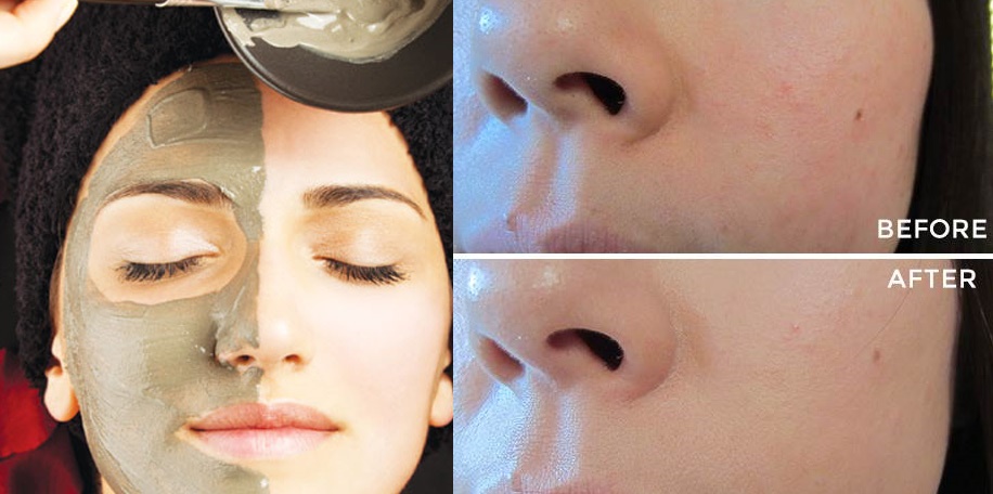 15 phút cho da sáng hẳn một tone nhờ baking soda trộn với thứ này, càng làm càng thích