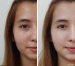 Trộn 3 thứ này với nhau, mụn tự hết vĩnh viễn, da tự trắng lên rõ rệt