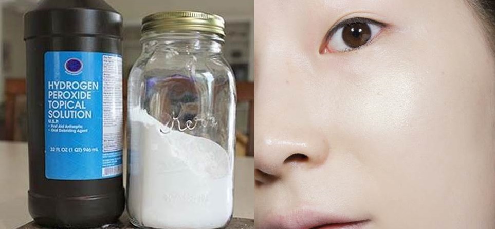 Dùng oxy già theo cách này, da trắng mịn, bật tone rõ rệt chỉ sau vài lần thực hiện
