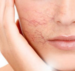 6 Bước làm dày da mặt mỏng hiệu quả 100%