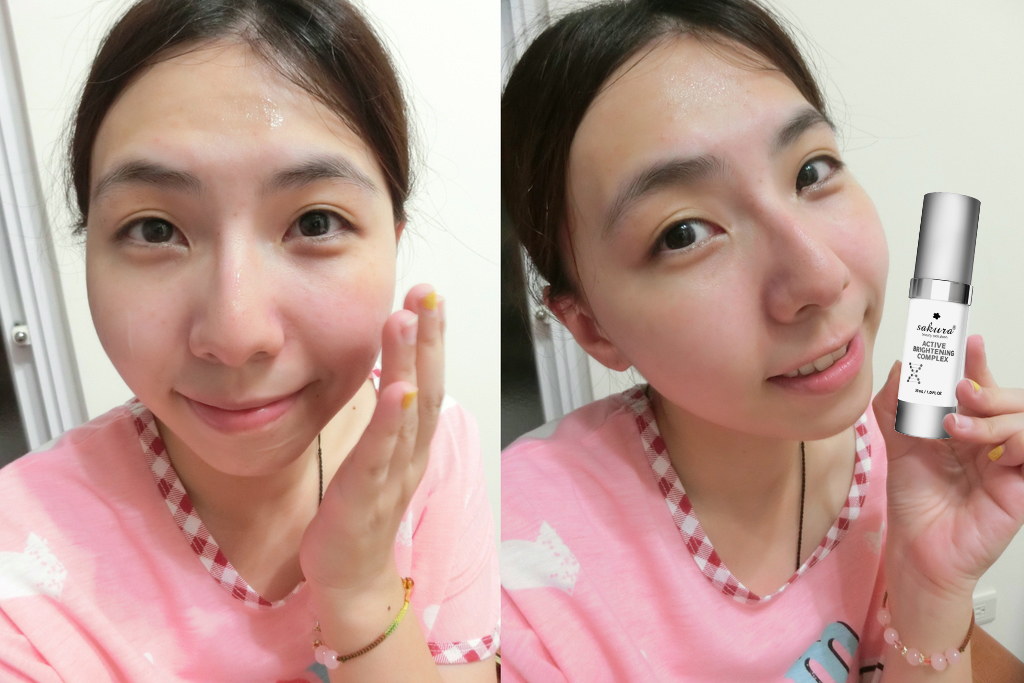 Dành 1 phút để biết thâm mụn của bạn đang ở mức độ nào và điều trị vĩnh viễn