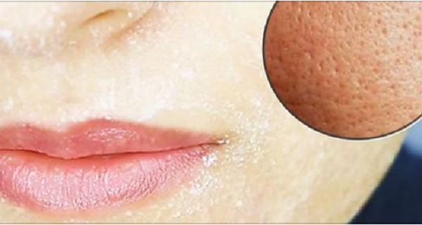 Bí kíp giúp se khít lỗ chân lông bạn nên thuộc ‘nằm lòng’!!!