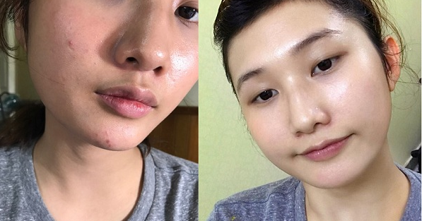 Chị em nào muốn sở hữu làn da trắng bóc, mi dày dài và hết thâm nách thì làm điều này 3 lần/tuần nhé!