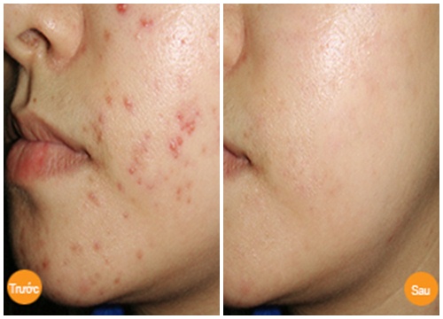 “Thay da đổi thịt” từ đầu đến chân chỉ với 1 nguyên liệu trong bếp, chị em đã biết chưa?