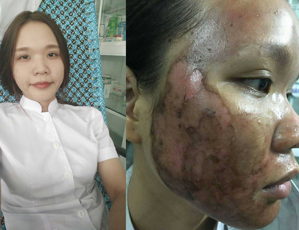 LỜI CẢNH BÁO dành cho các nàng chọn phương thức làm đẹp sai cách “RƯỚC HỌA VÀO THÂN”