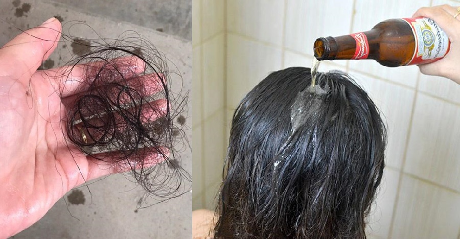 Đầu nhiều gàu trắng như tuyết, tóc rụng cả nắm mà không biết cách lấy bia gội để sạch khỏe, bóng mượt lại mọc ra dài nhanh
