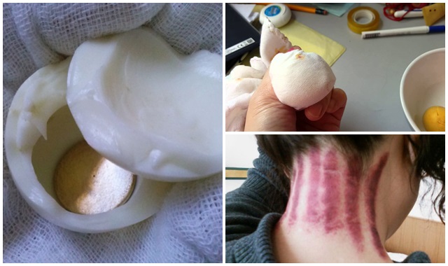 Dùng TRỨNG ĐÁNH GIÓ theo cách này, sau 2 phút là khỏi hết cảm lạnh, cảm cúm, người đang mệt lả cũng khỏe ngay lập tức