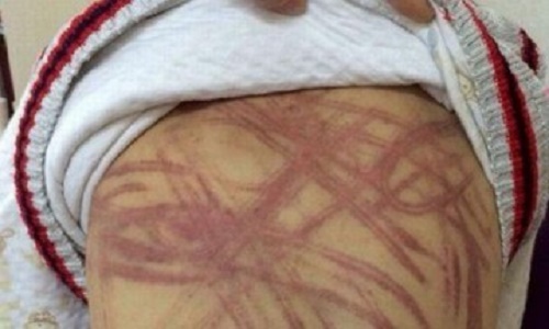 Mẹ ơi, xin đừng đánh con. Con đau lắm!