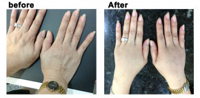 Bật mí 10 cách chăm sóc da tay mềm mại, trắng mịn làm cho đôi tay của bạn trẻ ra 10 tuổi