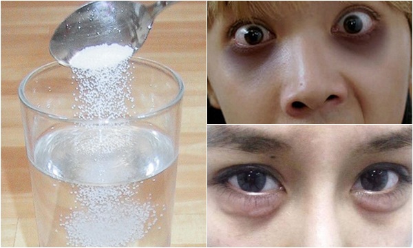 10 NGUYÊN LIỆU tự nhiên giúp LOẠI BỎ quầng thâm mắt hiệu quả, nhanh chóng chỉ trong VÀI NGÀY