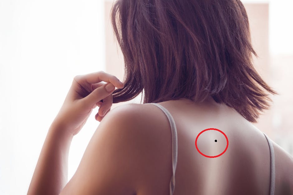 6 nốt ruồi MAY MẮN, TÀI LỘC ở lưng đừng bao giờ xóa bỏ