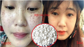 Mỗi ngày UỐNG 1 LY nước giải khát này vừa ngon lại vừa TRẮNG DA, NỞ NGỰC giúp bạn sớm thay da đổi thịt