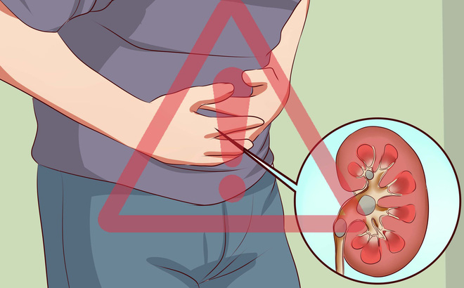 Những hành động phá hủy thận từng ngày có thể bạn vô tình mắc mà không biết