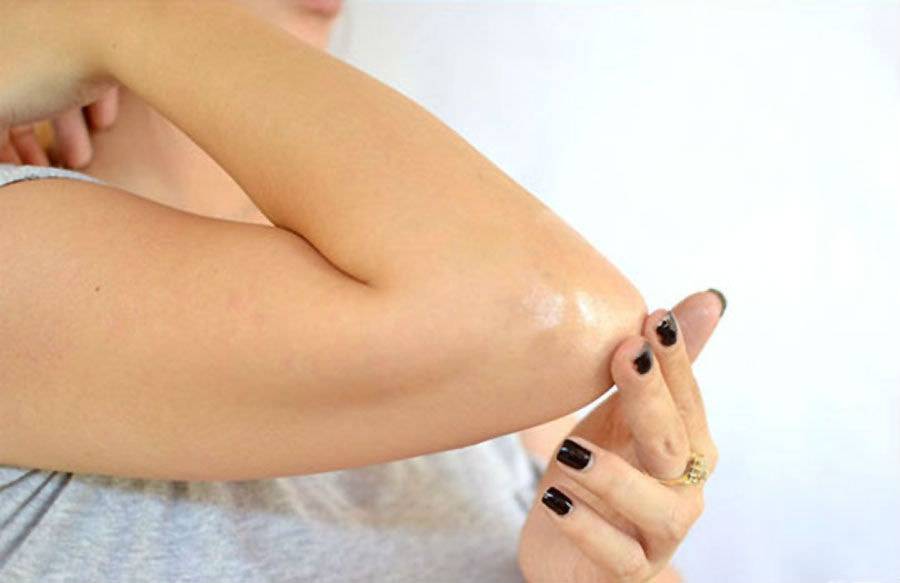 Học cách loại bỏ khuỷu tay thâm xì chỉ trong tích tắc với cách đơn giản