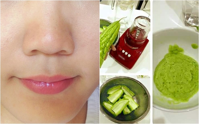 Sạch sành sanh mụn ẩn trong 2 tuần với tuyệt chiêu từ vài lát mướp đắng