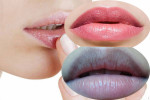 Dù là môi thâm do chì hay sinh ra vốn thế cũng phải đỏ hồng, căng mọng ngay tức khắc nhờ hỗn hợp này