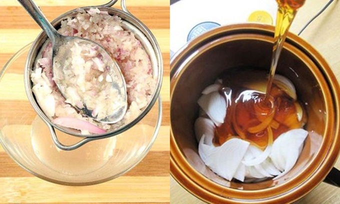 Lông mày mờ nhạt cũng dày, rậm, đẹp như búp bê sau 7 ngày chỉ bằng vài lát hành tím có sẵn trong nhà