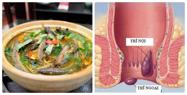 Trĩ lâu năm cũng khỏi sau 1 tháng nhờ vào loại thực phẩm được thế giới tôn vinh là nhân sâm nước